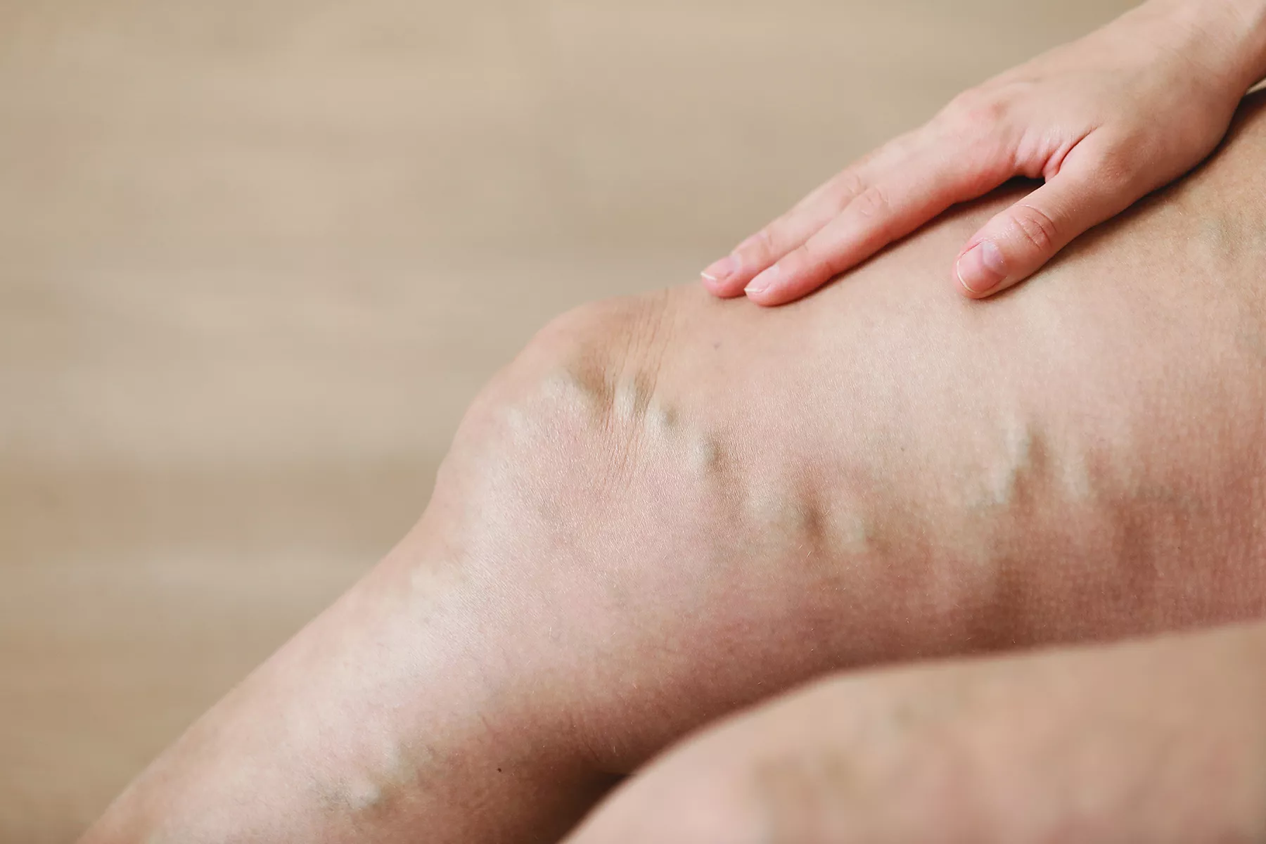 Learn the warning signs, treatments, and prevention tips for emergency vein diseases. Act fast to protect your health!