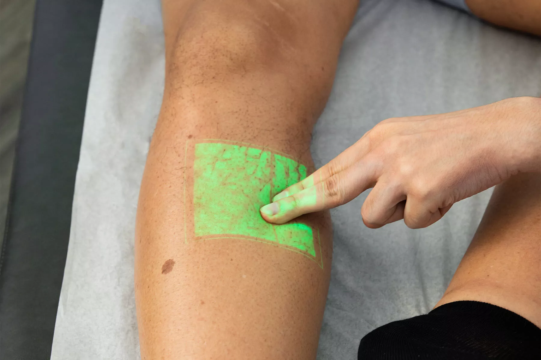 identifying DVT in men